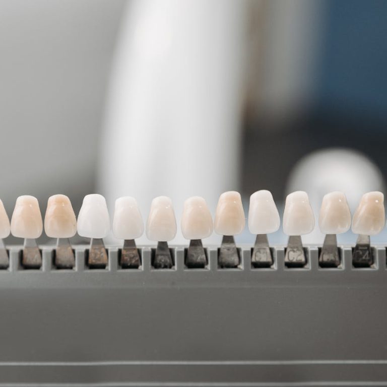 Veneers in Abuja - Bellevue Dental Clinic for Veneers Abuja Nigeria